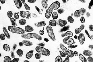 Researcher dies in a Siberian laboratory after a possible accident with a plague pathogen